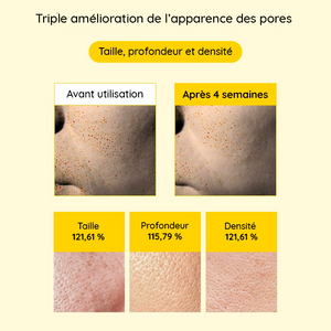 Spicule Retinol PDRN Cream