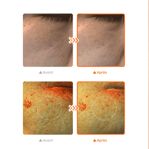Vitamin C Boosting Serum